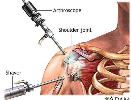“It’s just keyhole surgery!”